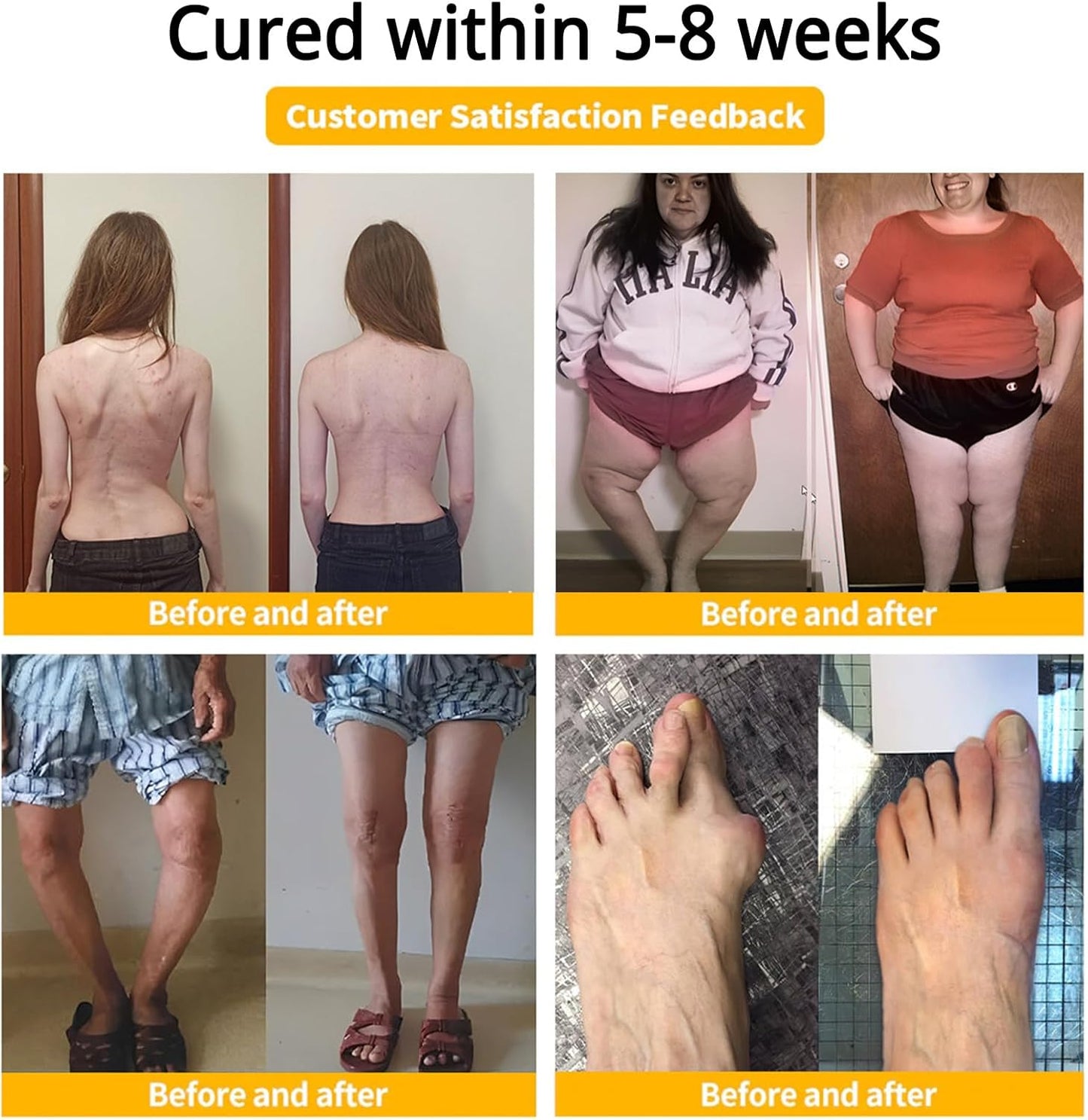 كريم ساوث مون - كريم مسكن للألم بسم النحل (الأصلي)