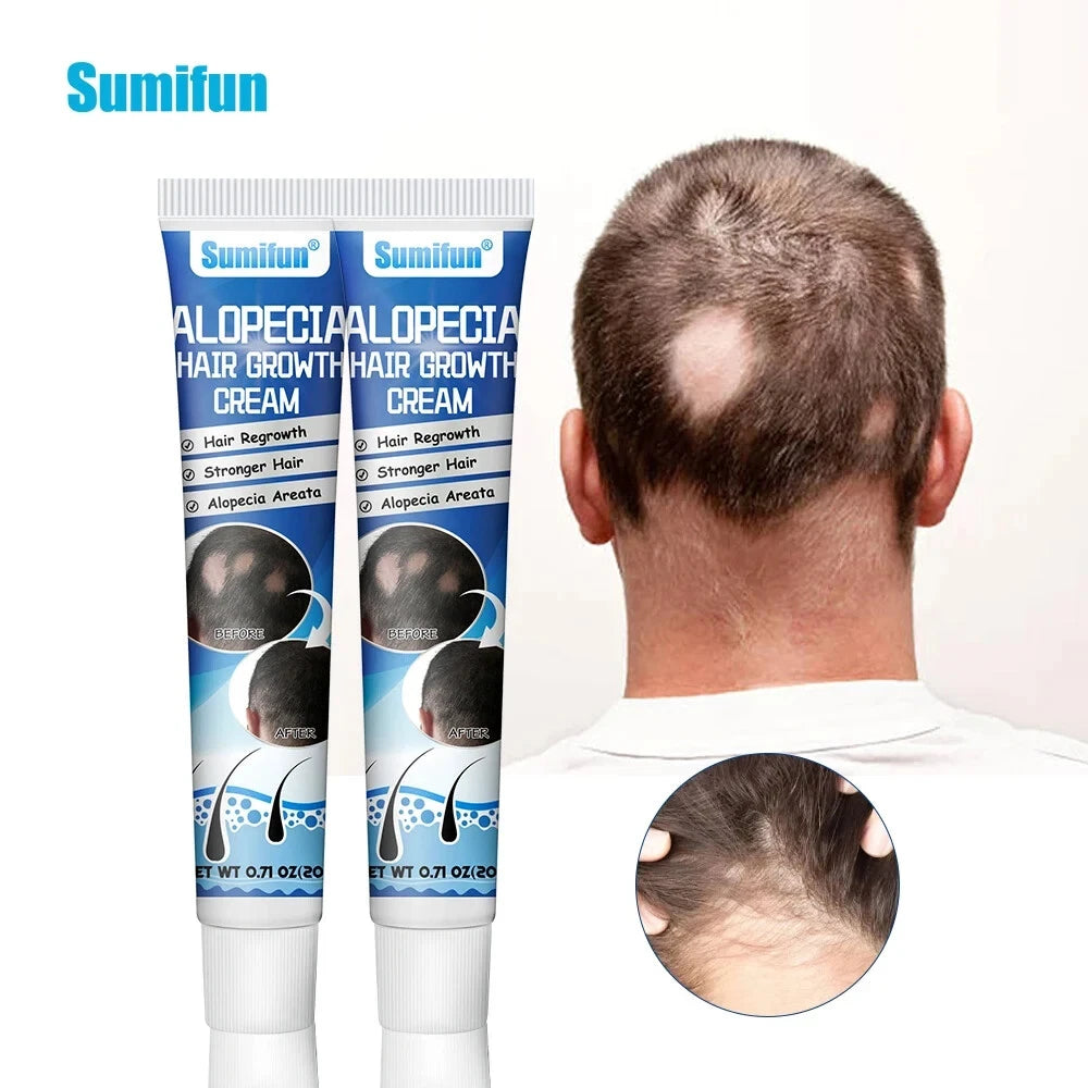 كريم سوميفون - لنمو الشعر