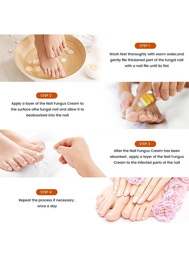 كريم سوميفون - كريم علاج فطريات الأظافر بسم النحل (الأصلي)