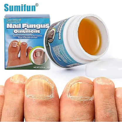 Sumifun - Nail Fungus Ointment (Original)