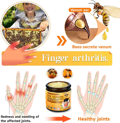 كريم ساوث مون - كريم مسكن للألم بسم النحل (الأصلي)