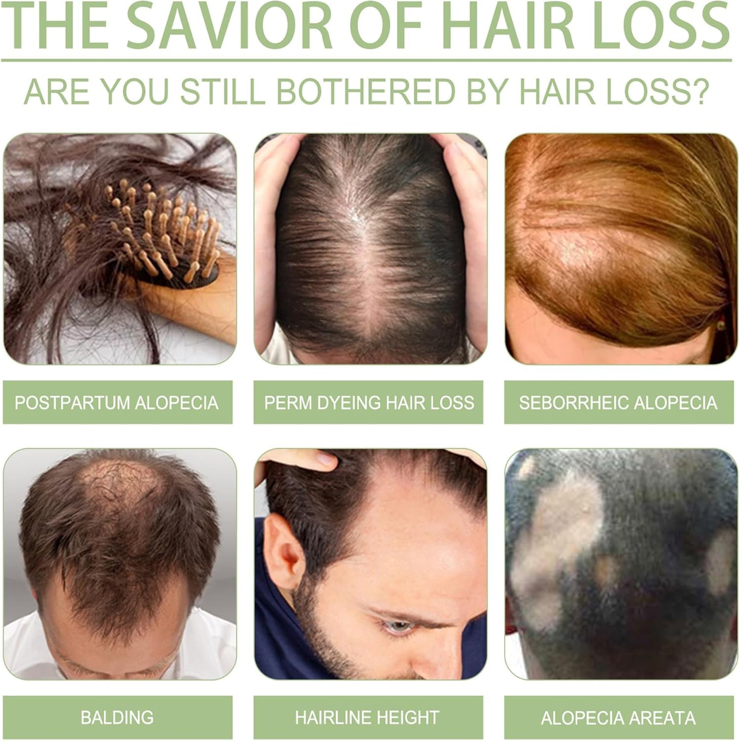 زيت الشعر أديفاسي (OUHOE)