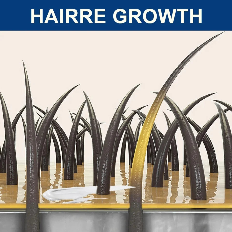 كريم سوميفون - لنمو الشعر