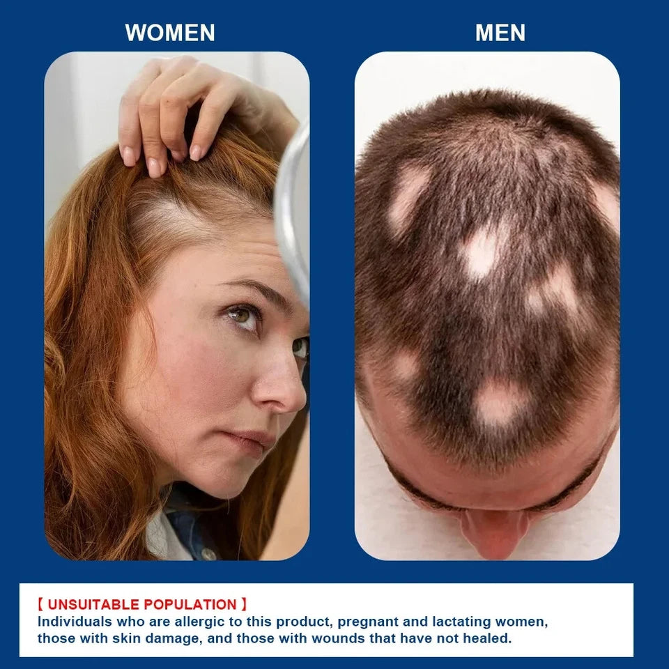 كريم سوميفون - لنمو الشعر