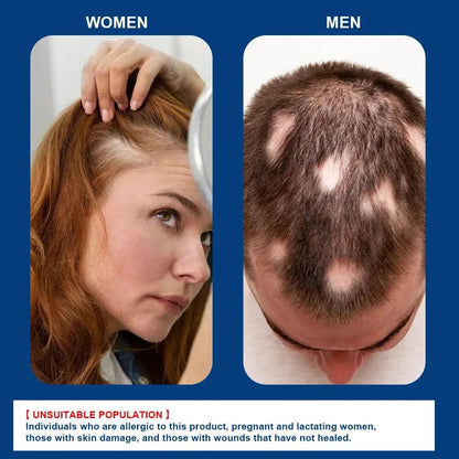 كريم سوميفون - لنمو الشعر